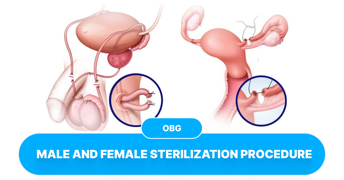 sterilization procedures